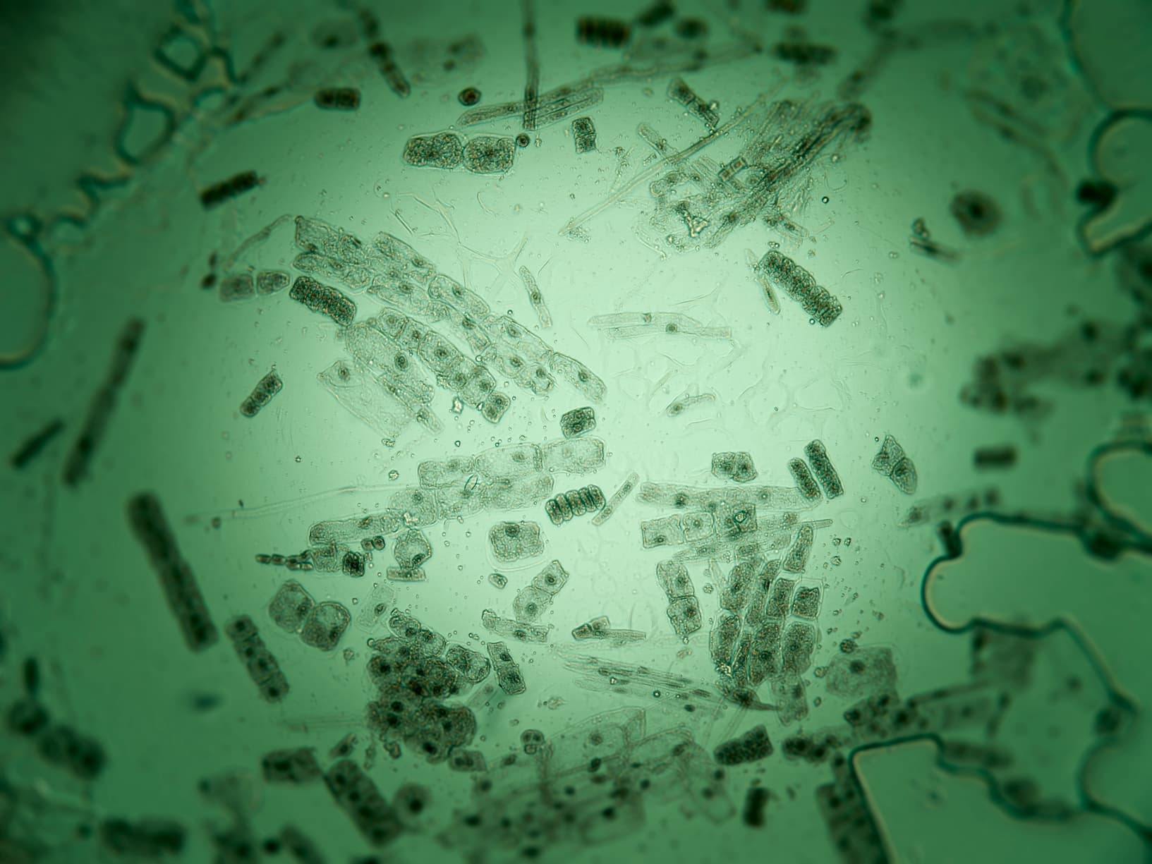 Microscopic diatoms in vivid green, representing cellular-level diagnostics